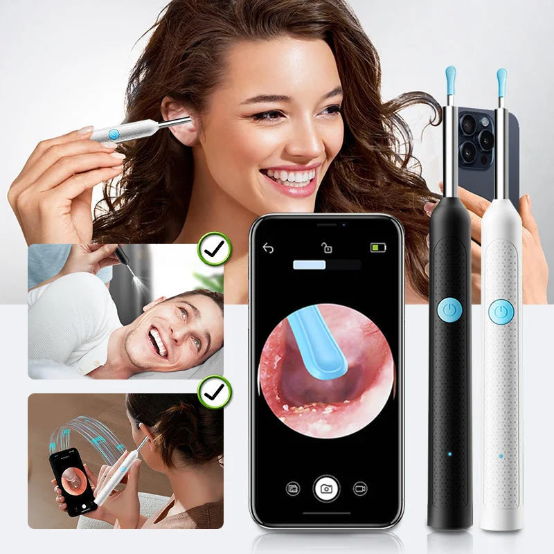 EarView™ – Limpia tus oídos con precisión HD y sin riesgos