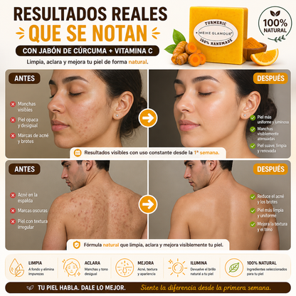 PACK X2 Jabón de Cúrcuma + Vitamina C – Aclara, Limpia y Renueva tu Piel Naturalmente