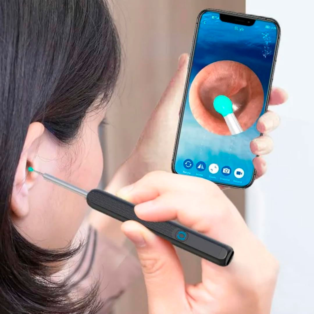 EarView™ – Limpia tus oídos con precisión HD y sin riesgos